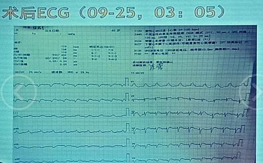 噬血芭蕾 视频海报