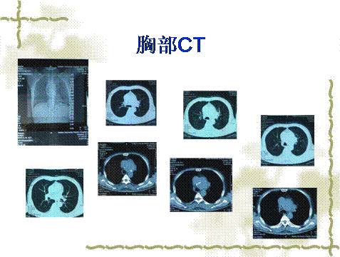 卧虎悍将 视频缩略图