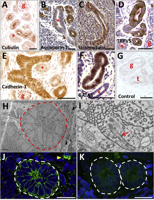 不死的讨债人 视频缩略图